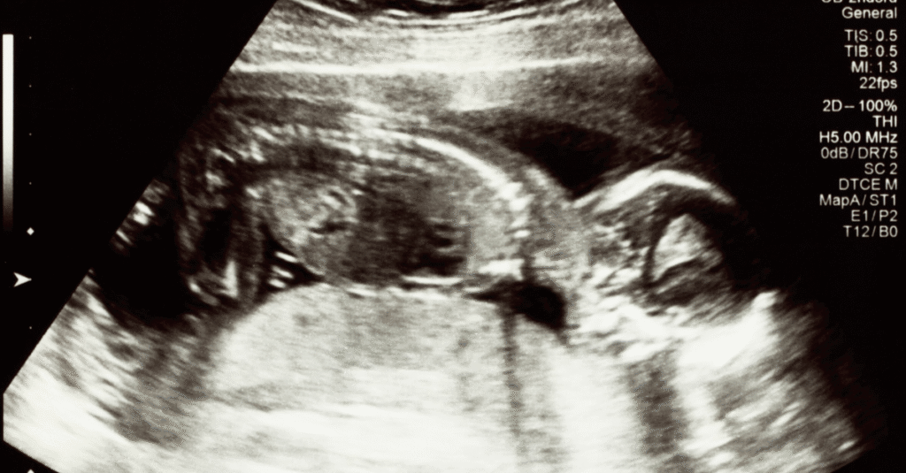 trying to conceive success photo