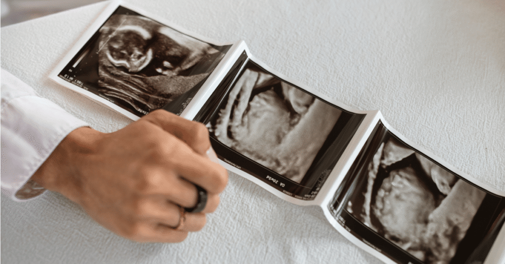 images of the womb during a healthy ivf process