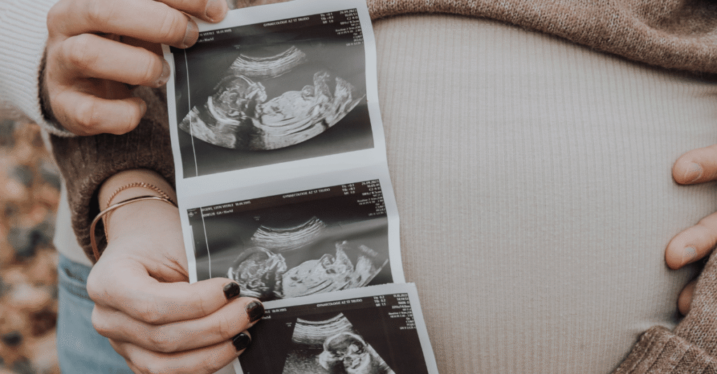 couples trying to conceive positive outcomes